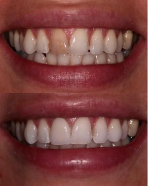 Advance Dental Care, Barry Advance Dental Care, Barry