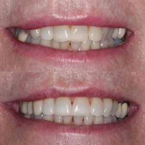 Advance Dental Care, Barry Advance Dental Care, Barry