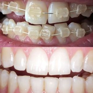 Advance Dental Care, Barry Advance Dental Care, Barry